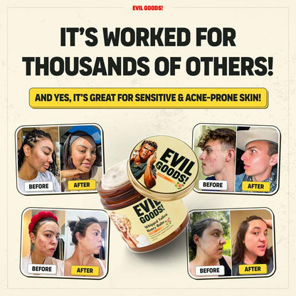 EVIL GOODS! Whipped Beef Tallow & Manuka Honey Organic Nourishing Face Cream Moisturizer Body Lotion Skin Care Lip Balm Hydrating Moisturizing 100% Natural Ingredients - Oil