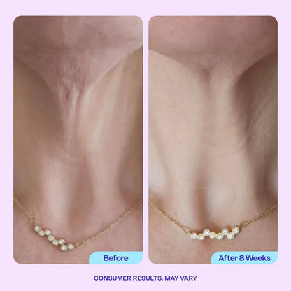 Advanced Firming Neck Cream – Visibly Lifts & Tightens "Turkey