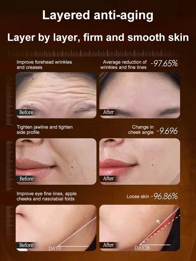 Micro-molecular collagen anti-wrinkle lotion