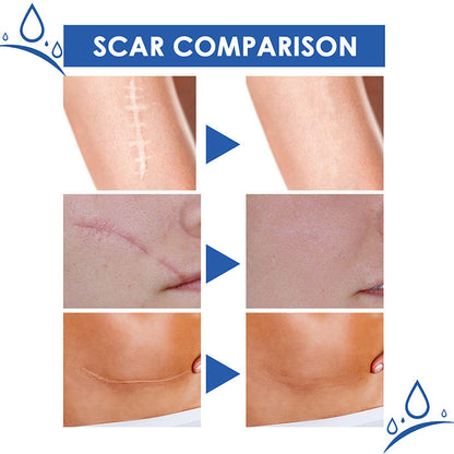 Scar Repair Cream
